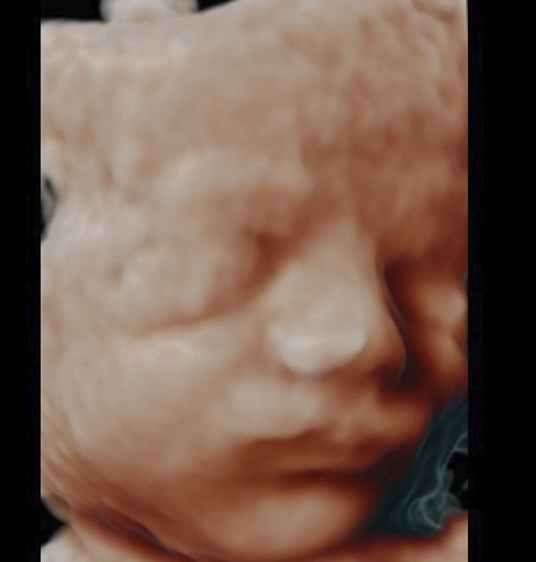 Ecografía del rostro del bebé lista para subir en Be·ia