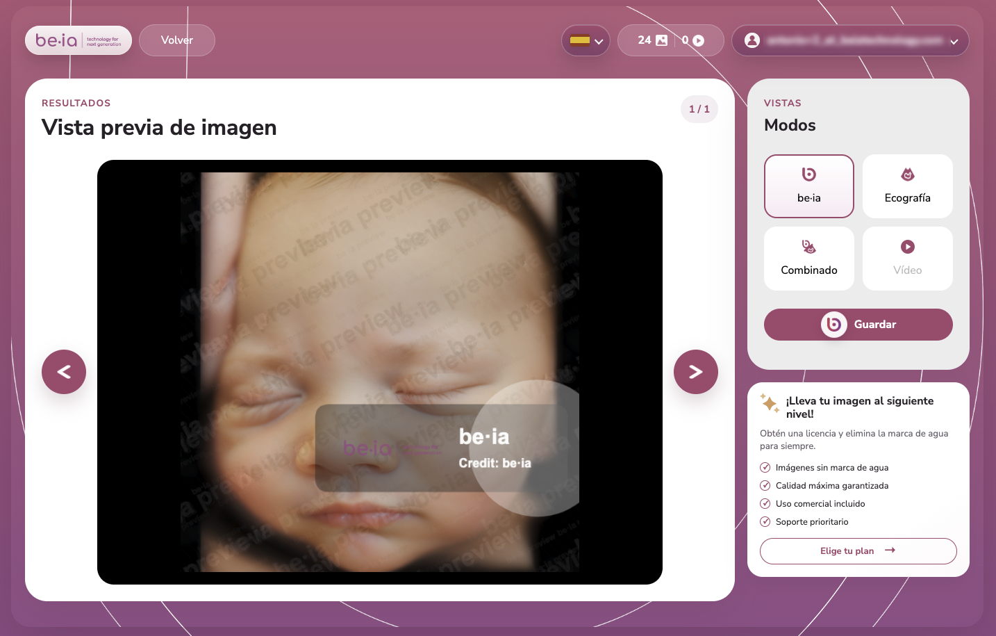 Web app de Be·ia para subir ecografías