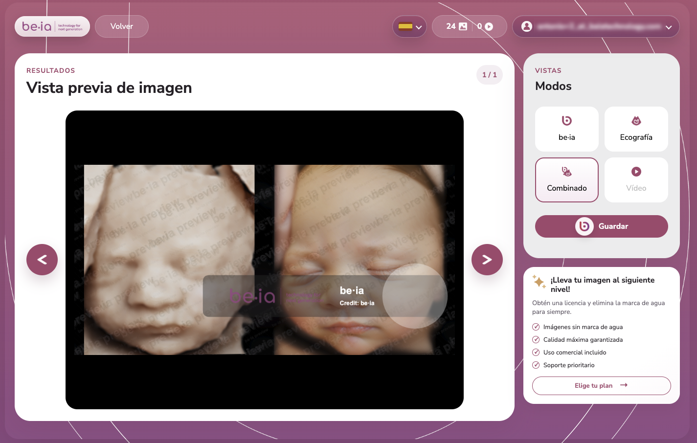 Web app de Be·ia para subir ecografías