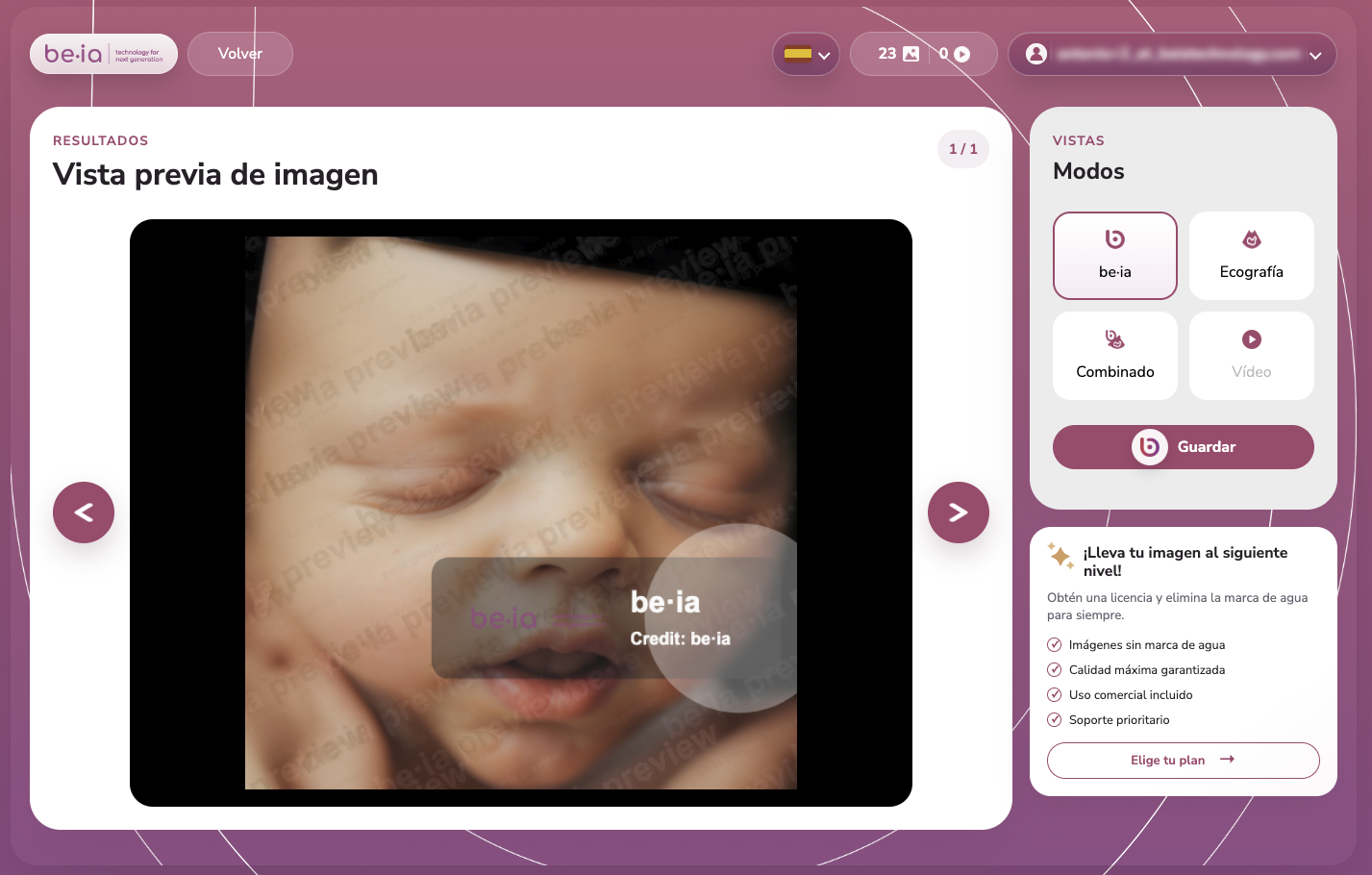 Web app de Be·ia para subir ecografías