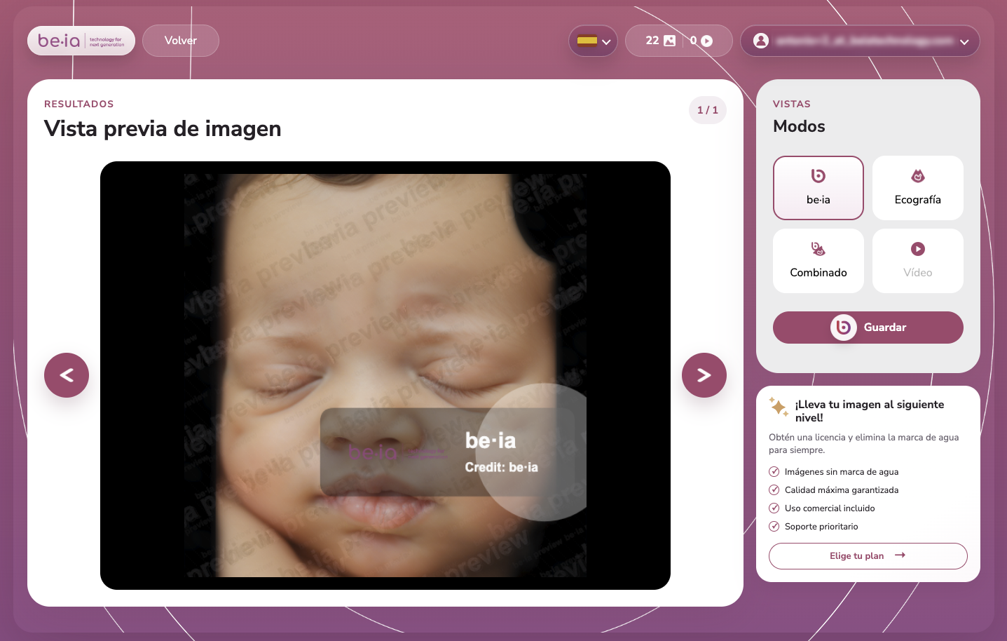 Be·ia web app para subir ecografías manualmente