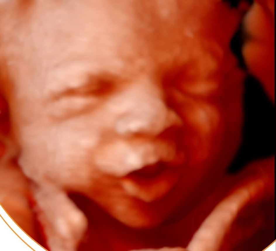 Ecografía original del rostro del bebé, ejemplo 11