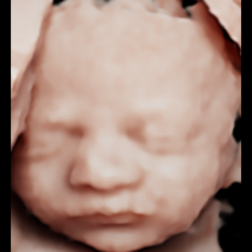 Ecografía original del rostro del bebé, ejemplo 02